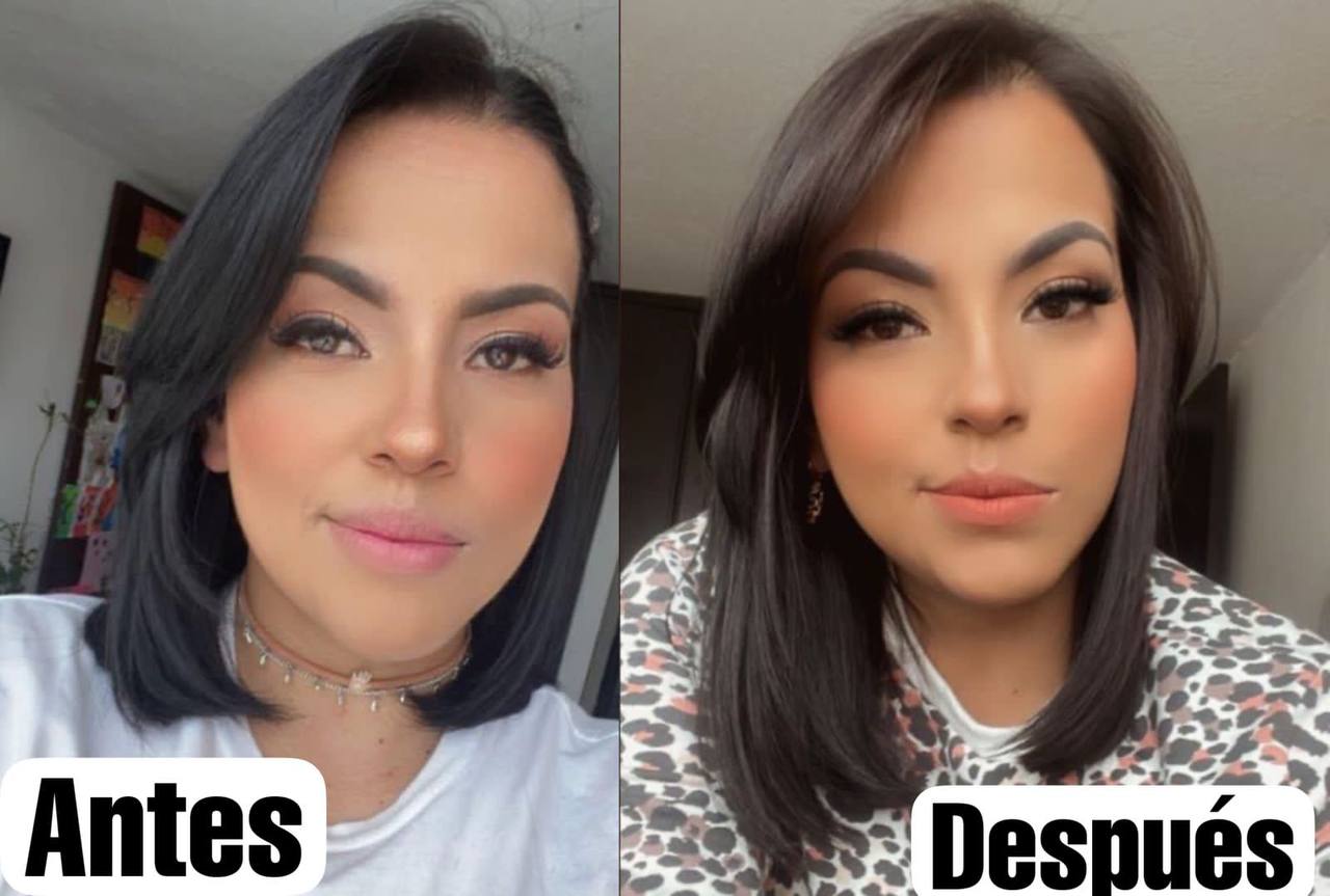 Tónico Capilar Anticaída