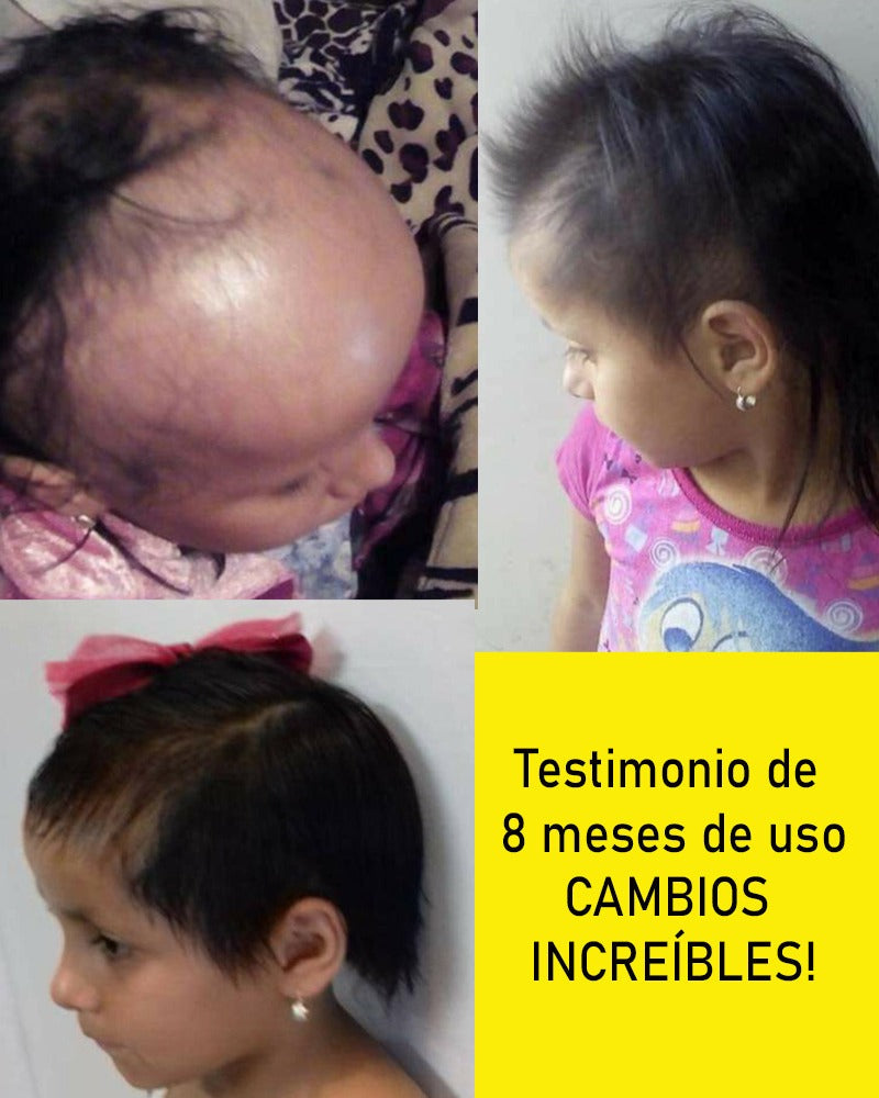 Tónico Capilar Anticaída