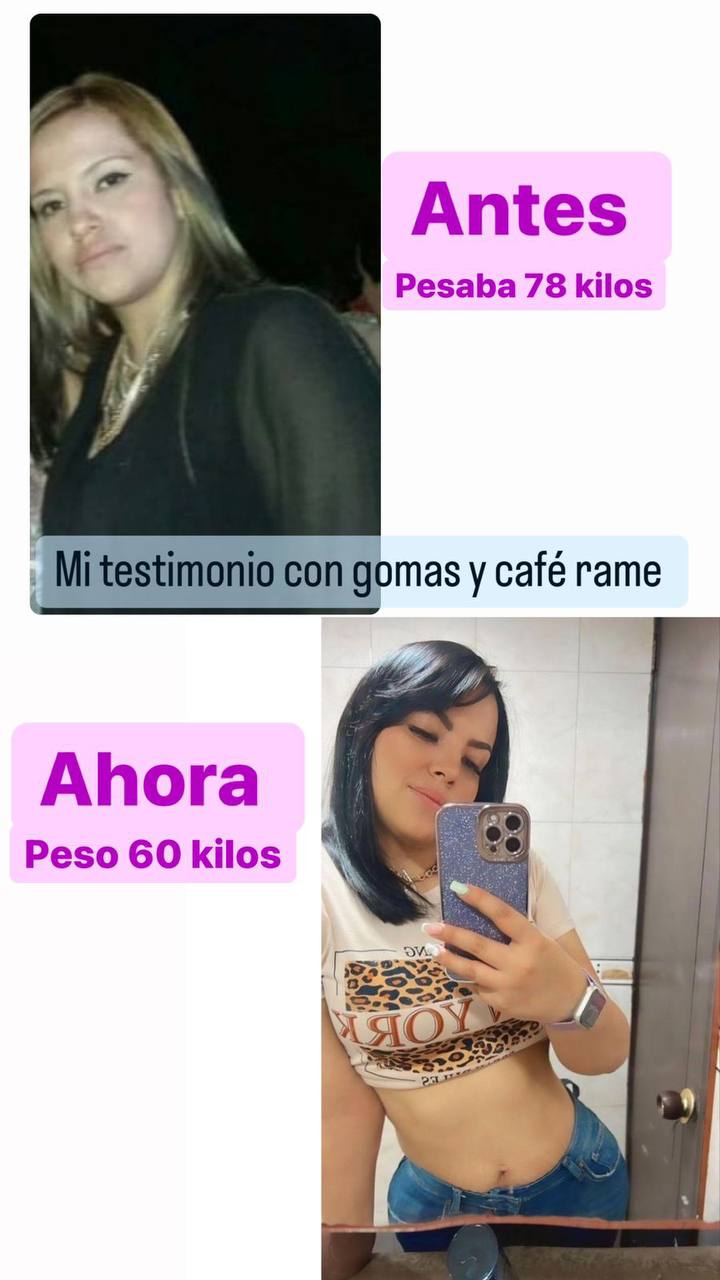GOMAS RAMÉ: Gomas de Café Verde, Ciruela, Pitaya, Piña – Reducción de Peso Natural, Sin Azúcar – 30 Dosis